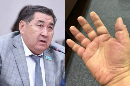 Депутат Ермұрат Бапидің қазіргі жағдайы белгілі болды