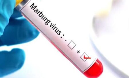 Марбург вирусы өршіді: қазақстандықтарға Руандаға бармауға кеңес берілді