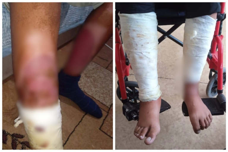 Қарағандыда жасөспірім қатарласына сіріңке лақтырып, өртеп жібермек болды деген ақпарат тарады