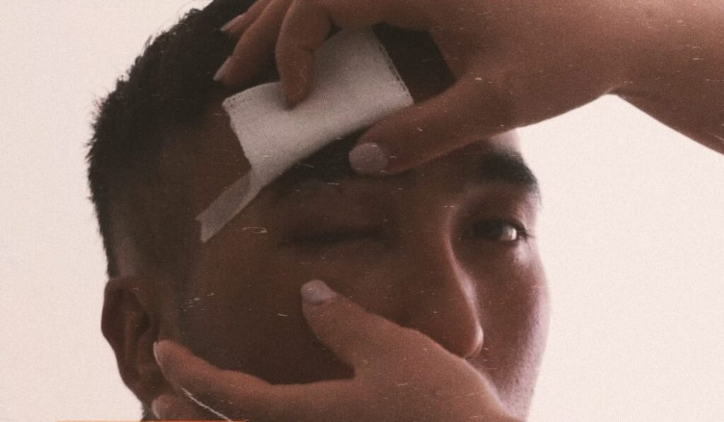 Жақсылықтың жанары: Жамбылдағы әскери «қойылымның» қасіреті бас жарақаты